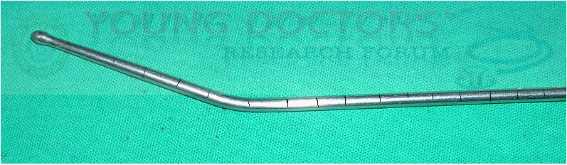 Instruments used In Gynecology and Obstetrics ~ YOUNG DOCTORS' RESEARCH ...