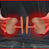 If Your Kidney Is In Danger Mode, The Body Will Give You These 7 Signs - Signs of Kidney Damage