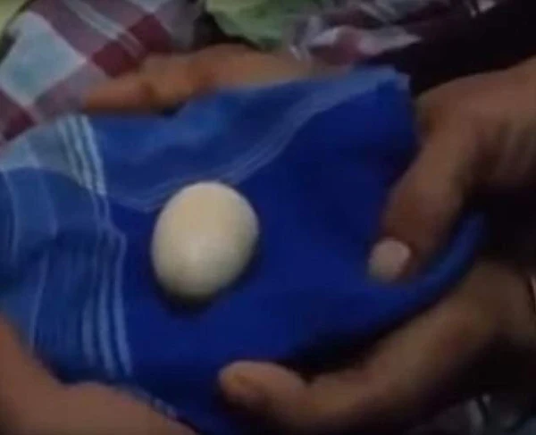 Teenage boy claims to have laid 20 eggs from his rectum in the past two years, Treatment, Hospital, Doctor, Father, Study, World