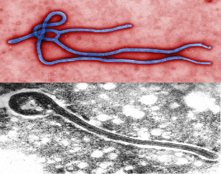 Ebola and Marbug viruses