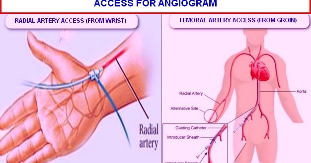 Dr Malleswara Rao MBBS MD DM Cardiology NIMS dr-prof-arati