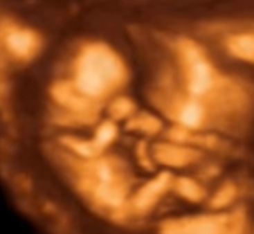 19 haftalık gebelik ultrason görüntüleri