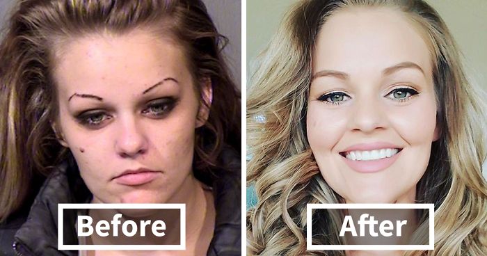 Powerful Before/After Photos Of Women Who QUIT Drugs. Powerful Before/After Photos Of Women Who QUIT Drugs.