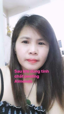 Peel da Almonds Biological Skin Peeling 36 38243750 2187902114778551 8268946577591107584 n