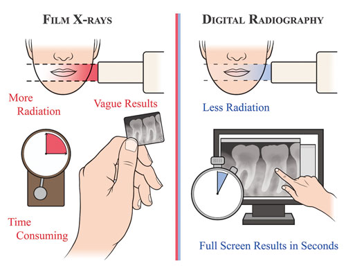 Gums And Teeth Laser And Implant Dental Center Are Dental