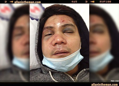 6-foot MMA fighter among Vhong Navarro's attackers