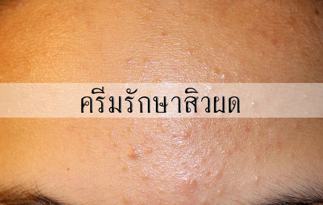รวมครีมรักษาสิวผด รวมครีมรักษาสิวผด