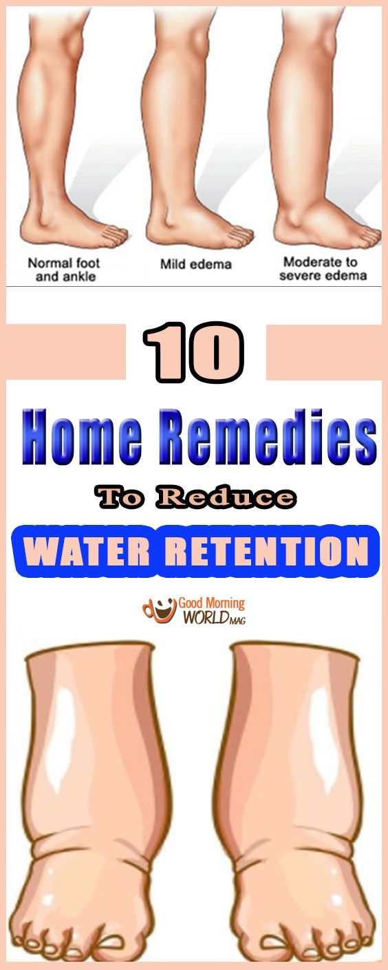 10 Home Remedies To Reduce Water Retention DIY AND CRAFTINESS