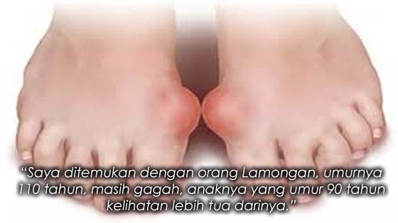 Penawar Sakit Gout Tradisional Paling Berkesan Didedahkan Penawar Sakit Gout Tradisional Paling Berkesan Didedahkan