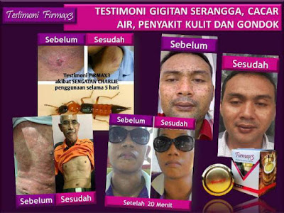 Testimoni Firmax3 Cream Testimoni Firmax3, Firmax3 firming & lifting cream, firmax3 testimoni, kesaksian firmax3, manfaat firmax3, khasiat firmax3, cara menggunakan firmax3, firmax3 murah, firmax3 untuk lelaki, firmax3 harga, firmax3 cream firmax