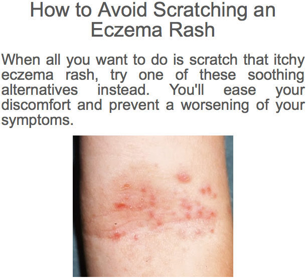 Foods That Can Cause Skin Rashes Foods That Can Cause Skin Rashes