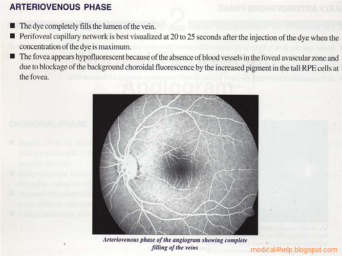 Fundus camera and retinal angiography fluorescein pathway and timing