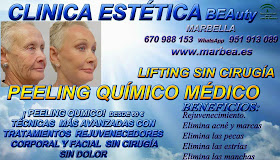 MANCHAS ,PECAS , ESTRÍAS , MARBELLA PEELING FACIAL QUIMICO MEDICO PARA ELIMINACIÓN , QUITAR , TRATAMIENTO: ACNÉ , MARCAS , CICATRICES , MANCHAS ,PECAS , ESTRÍAS , MANCHAS