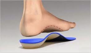 Plantar Fasciitis, Lakukan Langkah-Langkah Berikut Ini