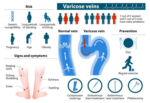 Venous-disease-infographic-nerdyrockson Venous-disease-infographic-nerdyrockson