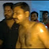  पत्रकार पर एसिड अटैक कर जानलेवा हमला।#Public Statement