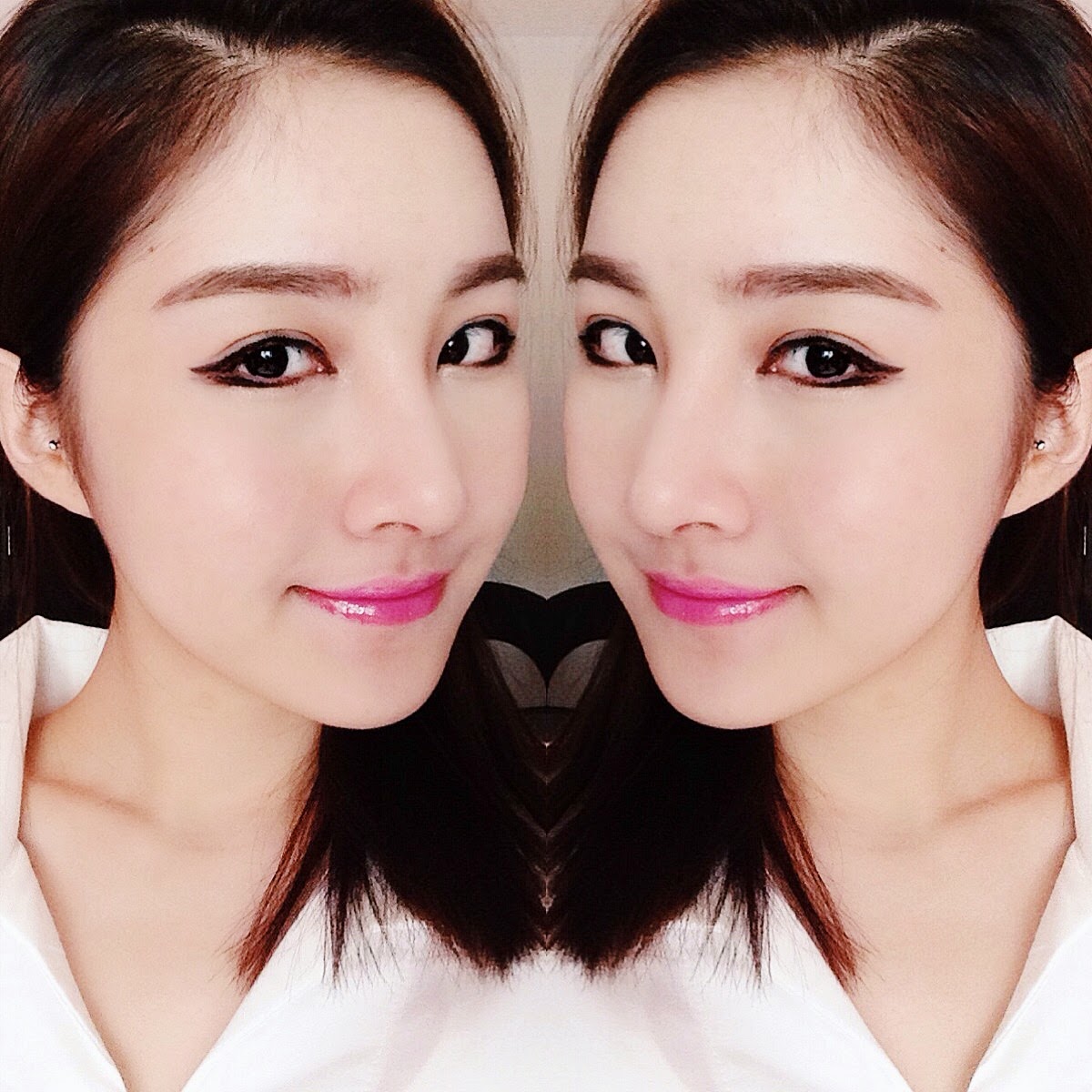 Thay đổi khuôn mặt nhờ bơm mỡ tự thân, cắt mí mắt Hàn Quốc kết hợp phẫu thuật nâng mũi sline Thay đổi khuôn mặt nhờ bơm mỡ tự thân, cắt mí mắt Hàn Quốc kết hợp phẫu thuật nâng mũi sline