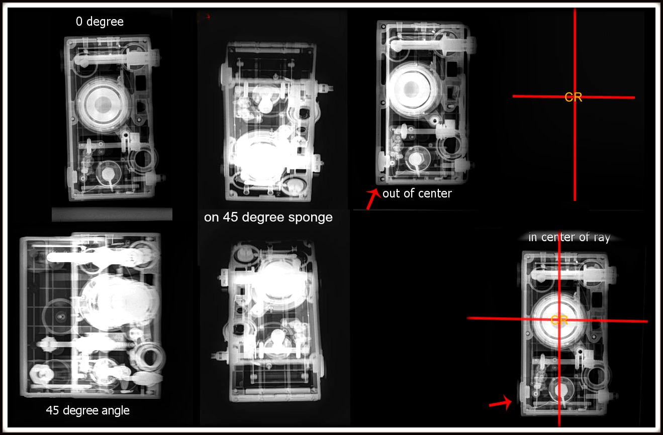 Topics in Radiography Shape Distortion