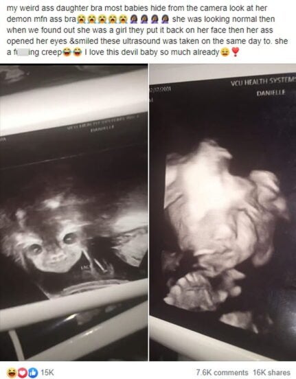 Staring ‘Devil Baby’ In Pregnancy Scan Scares A Young Mother To Be