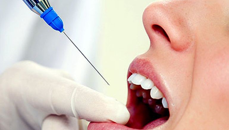 propagación de casos de agenesia dental propagación de casos de agenesia dental