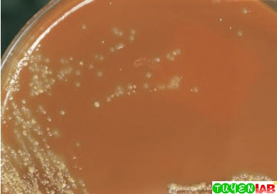 Chocolate agar (CHOC) does not display true hemolysis because the red cells in the medium have already been lysed. Bacteria that are hemolytic on blood agar plate usually are green around the colony on CHOC. Chocolate agar (CHOC) does not display true hemolysis because the red cells in the medium have already been lysed. Bacteria that are hemolytic on blood agar plate usually are green around the colony on CHOC.