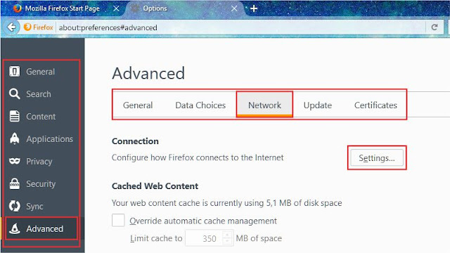 Advanced - Network - Settings Advanced - Network - Settings