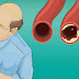18 Foods to Clear Your Arteries and Protect You from Heart Attacks