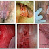 Bintik Merah kecil Di Bibir Vagina Seperti Daging Tumbuh