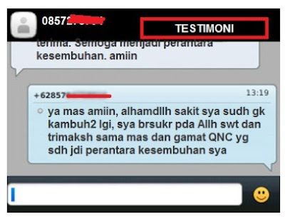 Cara Mengobati Varises Di Kaki Pada Ibu Hamil