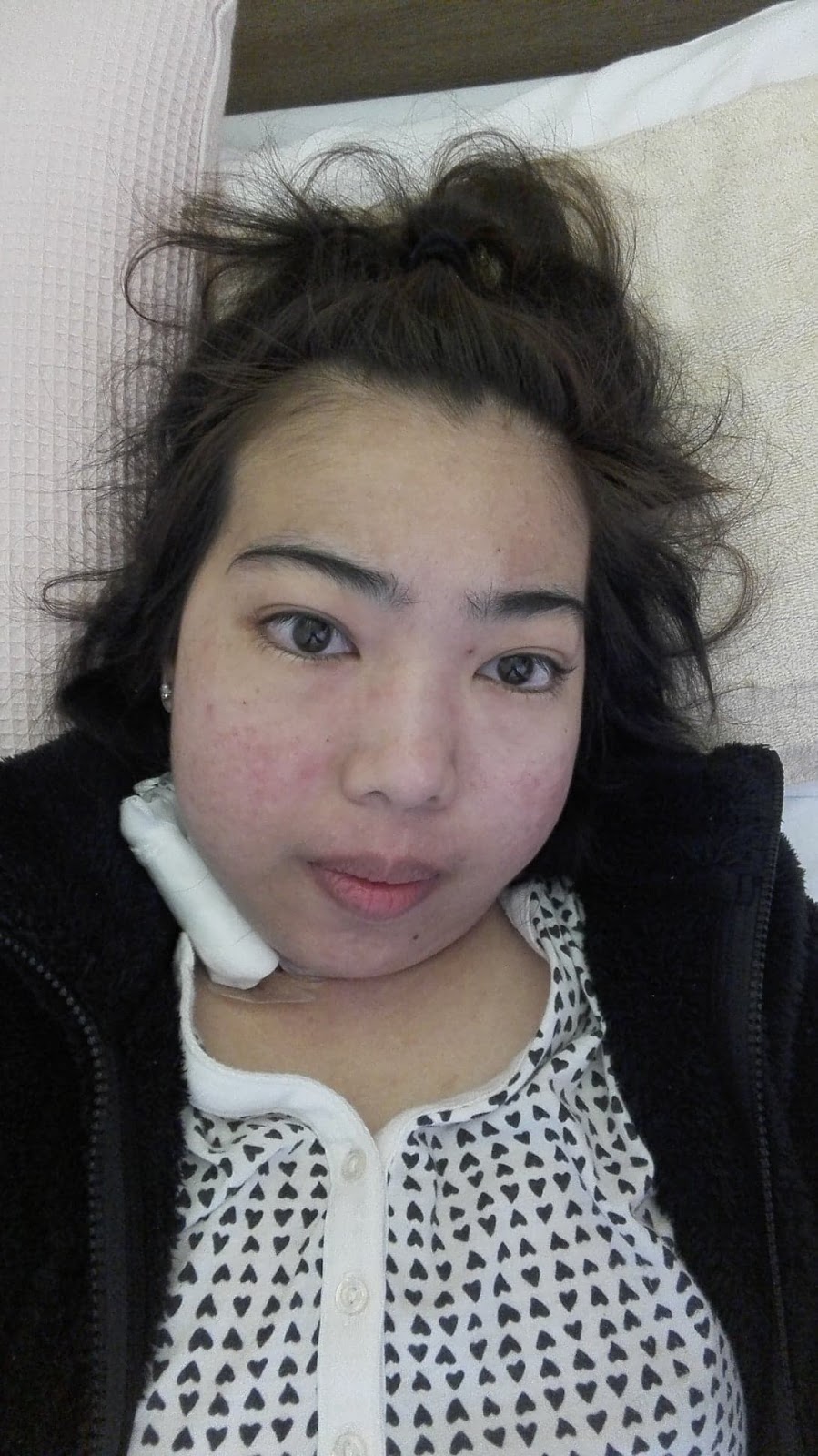 Fighting Lupus in Japan New roller coaster ride! July 1, 2018 (Sunday)