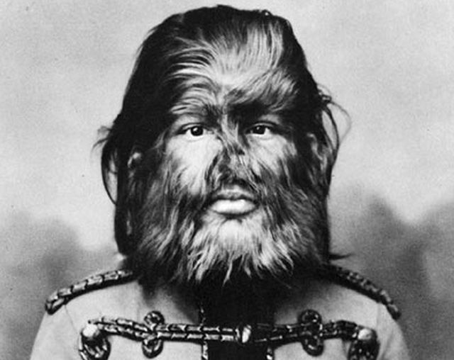 The-dog-faced-boy