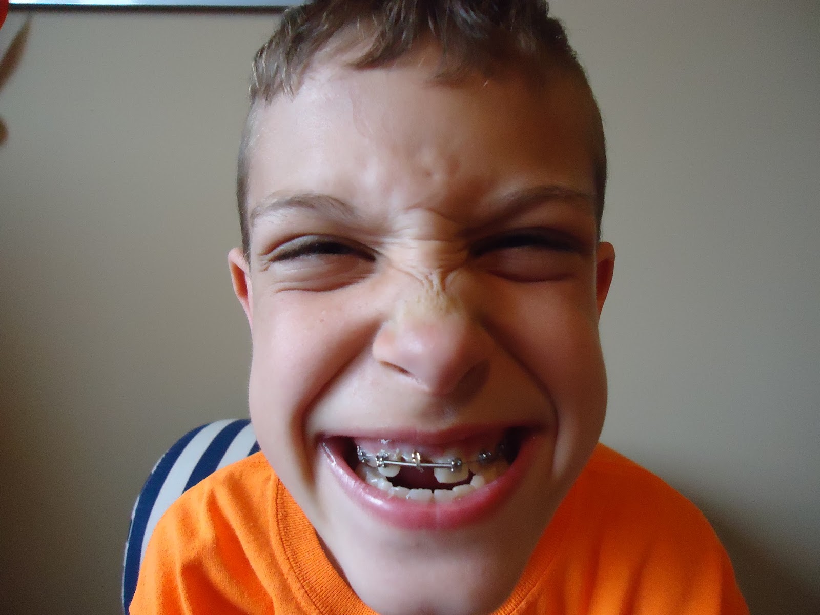 The Kuznia's Crazy Life Operation Right Front Tooth