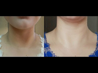 Kali Gardan Kali Gardan aur Kali Kuhani ko gora karne ke upay aur gharelu nuskhe. Home remedies & tips for Black Neck, Black Elbows to getting white.