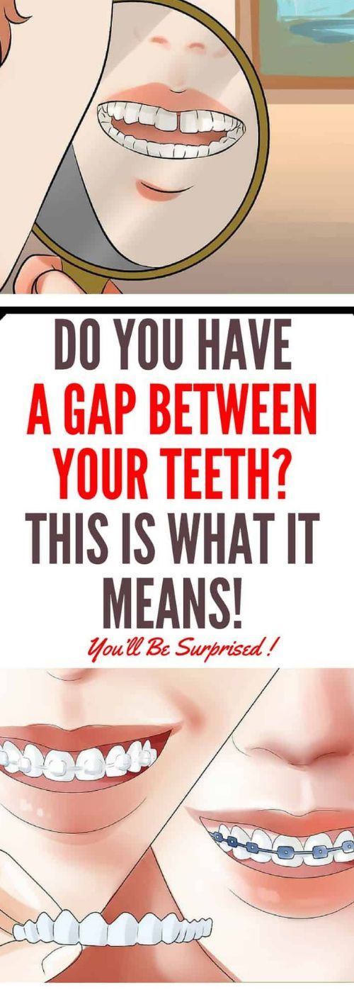 gap teeth between slim start though let means ways been