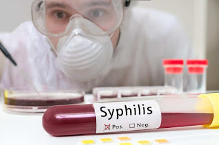 Nama obat sipilis ampuh resep dokter di apotik