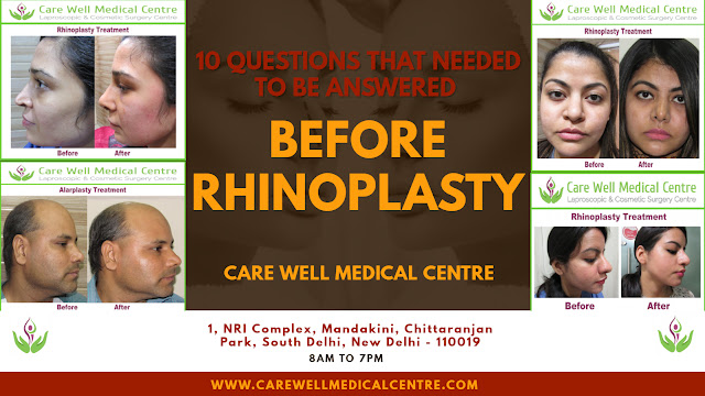 rhinoplasty in delhi