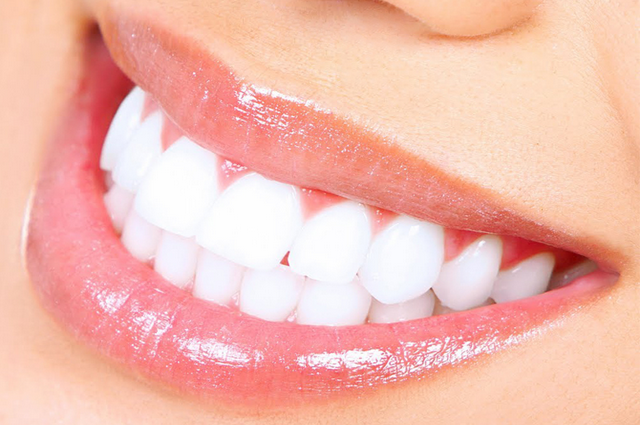 7 Cara Menjaga Gigi Anda Supaya Kuat Dan Sehat