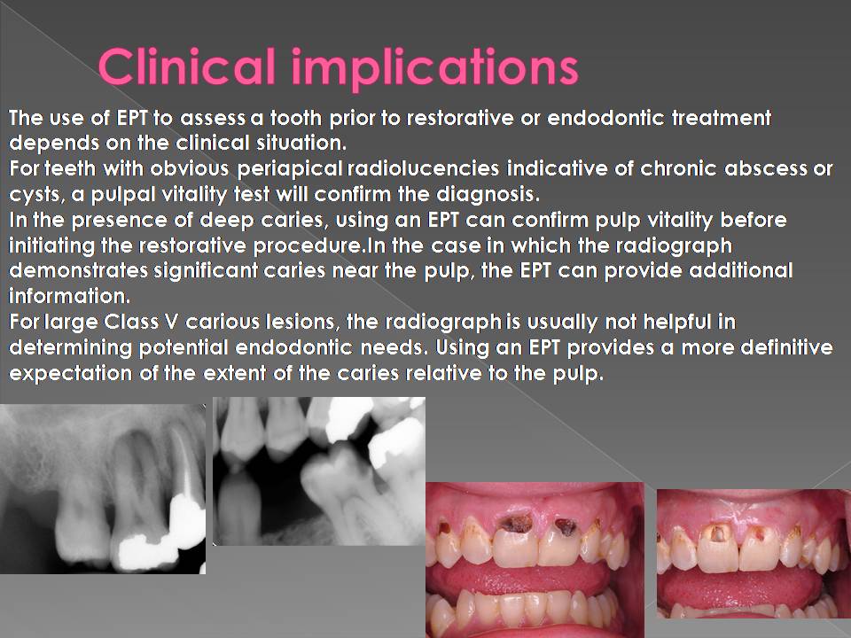 DOs and DONTs in DENTISTRY ELECTRIC PULP TESTING DO IT THE RIGHT WAY