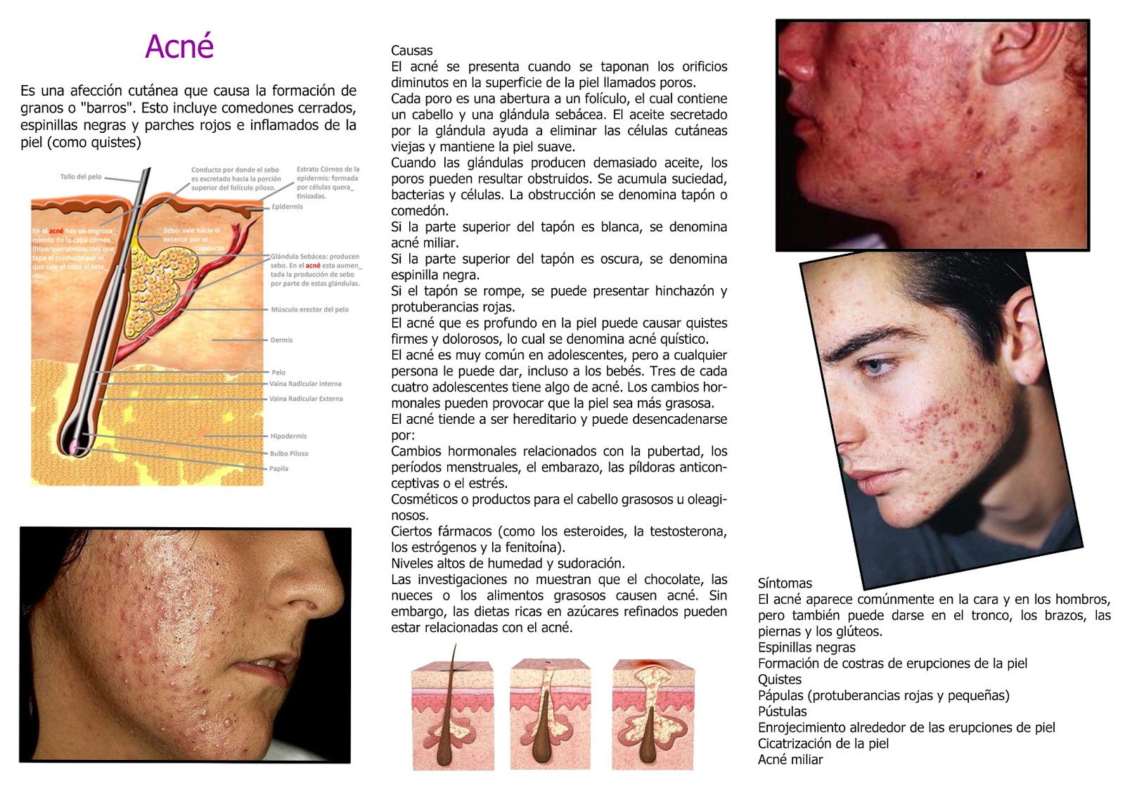 Quanto às Glândulas Sebáceas é Incorreto Afirmar Que
