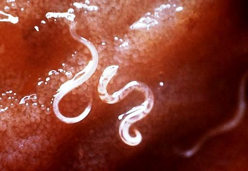 ankilostomiasis patogenezis nagy férgek kezelése emberben