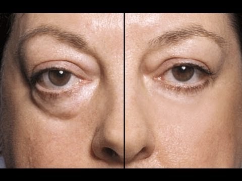 recenzii despre cea mai bună cremă pentru ochi anti-îmbătrânire