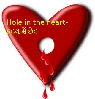 Hole in the heart