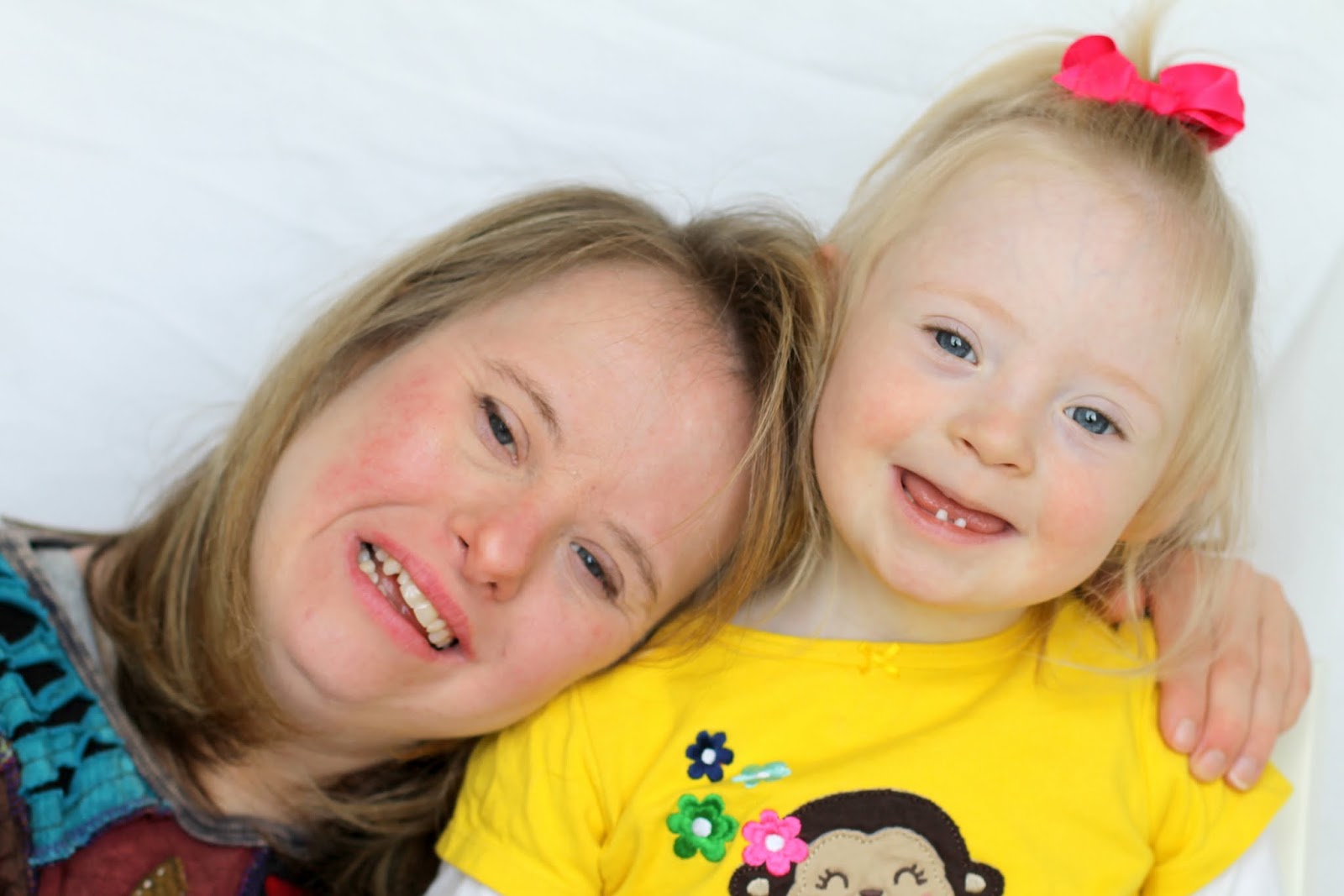 детишки с синдромом дауна. дедти с синдромо даунито. синдром дауна. синдром дауна. ребёнок с синтомом даунтон.