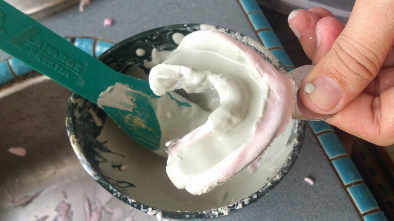 carolechic Orthodontics Retainers Moulding StepbyStep