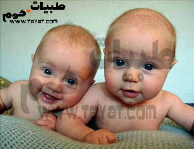 الحمل بتوأم twins pregnancy