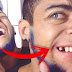 O Youtuber Everson Zoio Arranca dente com alicate e sofre ameaças de morte