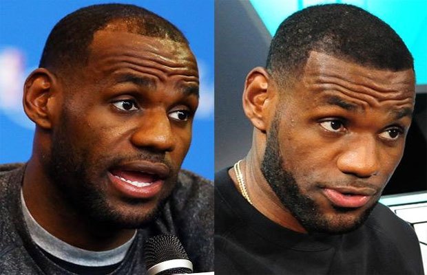 Lebron James Hair Loss Surgery Fue Vs Fut Linear Strip at OC Hair - lebron james hair transplant