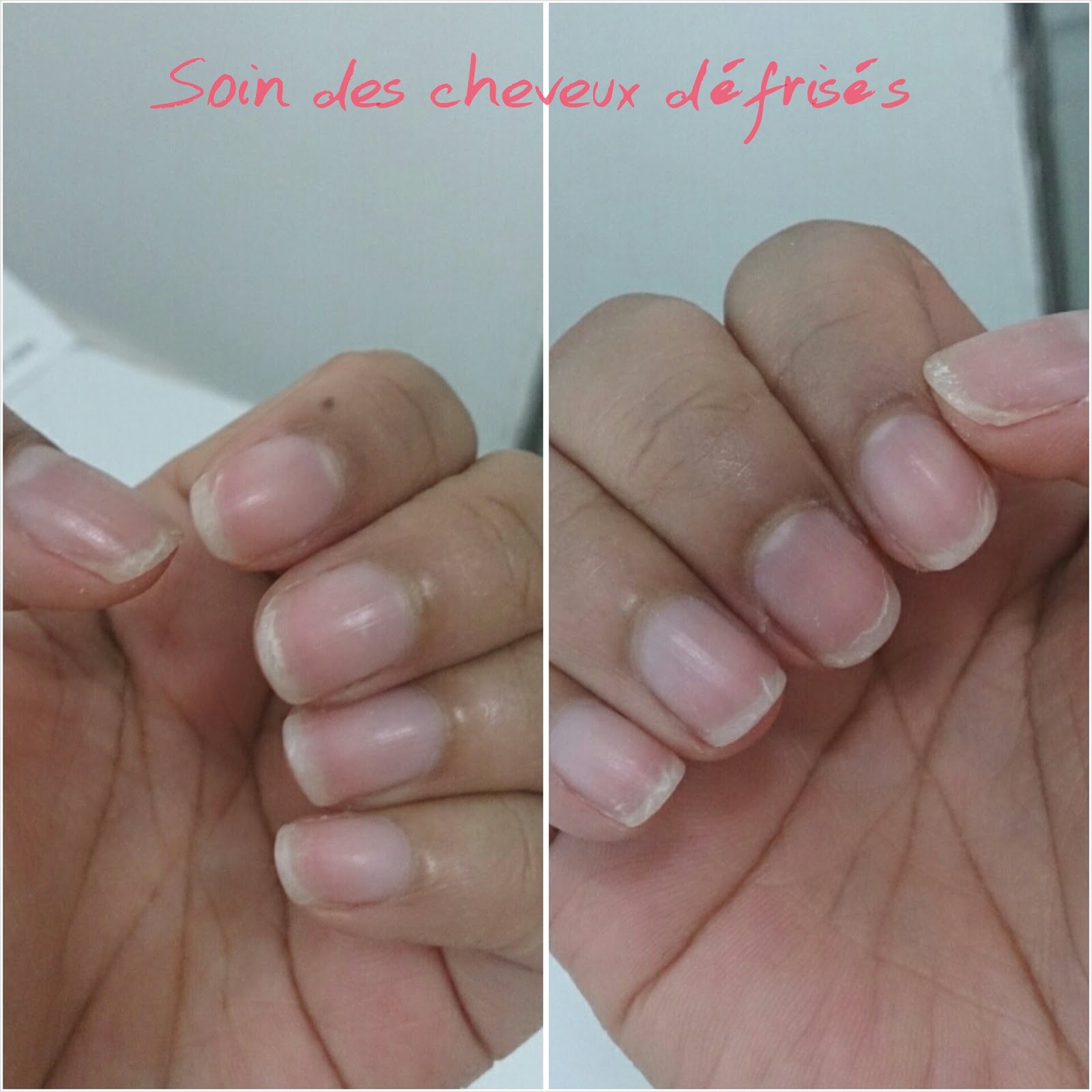 forcapil avant apres