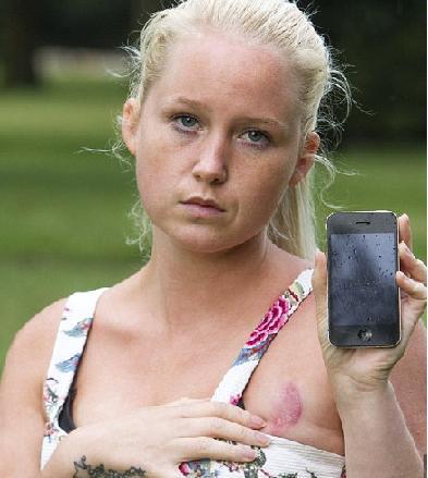 Tindih iPhone Panas, Dada Gadis Ini Luka Parah Tindih iPhone Panas, Dada Gadis Ini Luka Parah