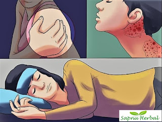 Obat Flu Tulang, Cara Menyembuhkan Penyakit Flu Tulang Secara Alami Sampai Tuntas